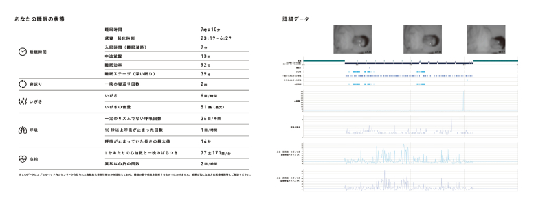 図2：睡眠レポートサンプル ※本サービスは、AIによる自動解析をレポートにしています